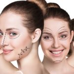 Anti Aging Procedures cover